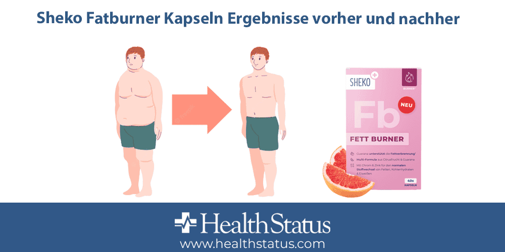 Sheko Fatburner Kapseln Ergebnisse vorher und nachher